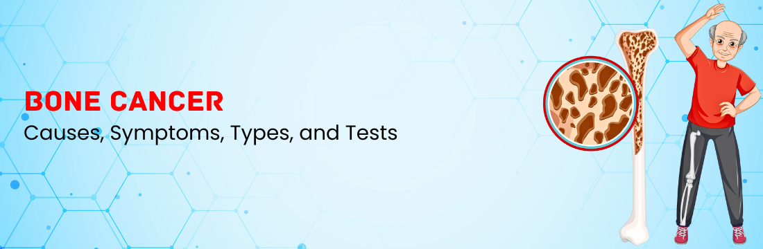 Bone Cancer Explained: Causes, Symptoms, Types, and Tests